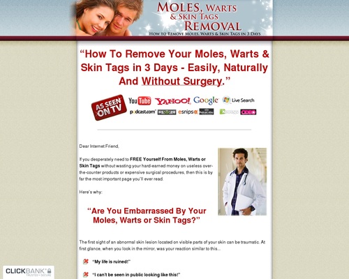 moleswarts x400 thumb Moles, Warts & Skin Tags Removal - How To Safely & Permanently Remove Moles, Warts & Skin Tags